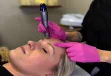 How Microneedling Benefits Skin Rejuvenation?