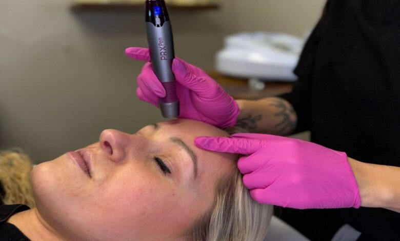 How Microneedling Benefits Skin Rejuvenation?
